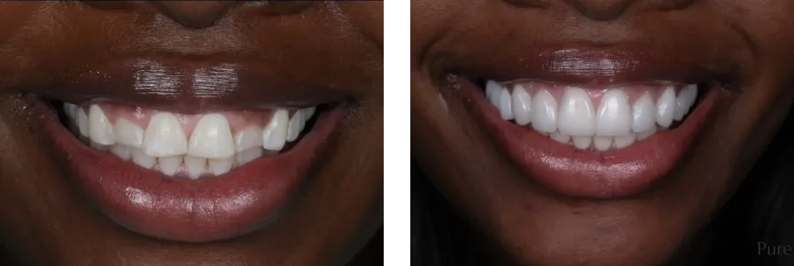 Before and after photo