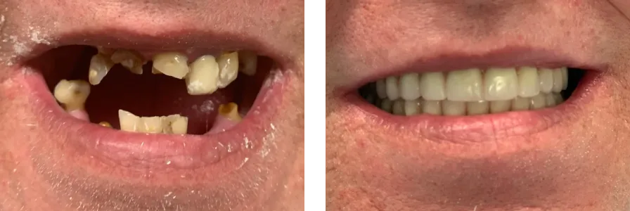 Before and after photo