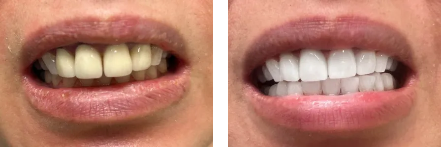 Before and after photo